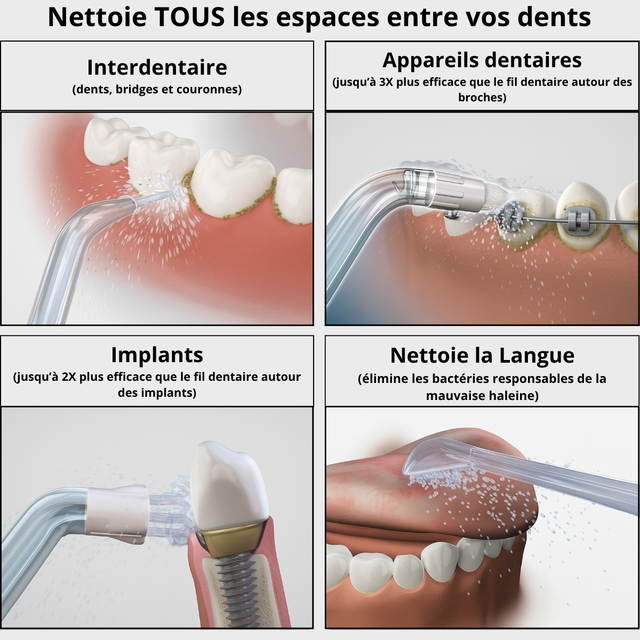 Embouts Hydropulseur